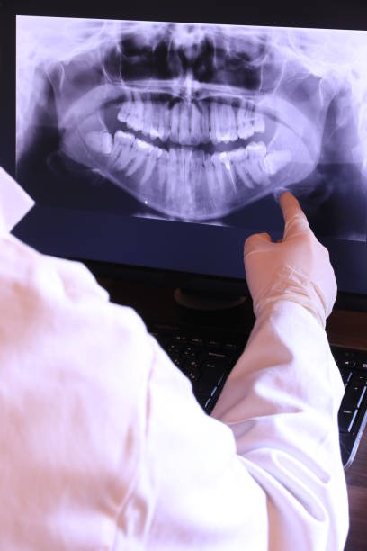 Best Emergency Wisdom Tooth Extraction in Tampa, FL